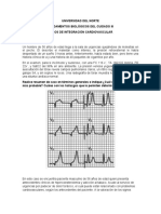 Caso 1 Cardiovascular