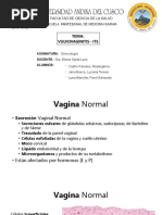 VULVOVAGINITIS ETS Unido 1