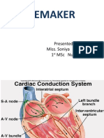 Pacemaker