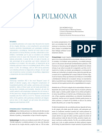 Embolia Pulmonar: Resumen