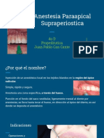 Anestesia Paraapical Supraperiostica PDF