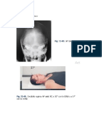 Dibujos Imagenologia Craneo Cara