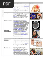 Enfermedades Del Sistema Nervioso