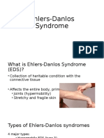 Ehlers-Danlos Syndrome