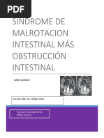 Sindrome Malrotacion Intestinal Mas Obstruccion