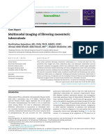 Multimodal Imaging of Fibrosing Mesenteric Tuberculosis