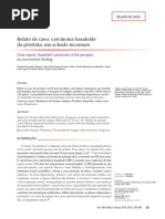 Relato de Caso Carcinoma Basaloide Da Próstata, Um Achado Incomum