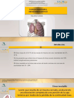 Torax Inestable y Hemomediastino