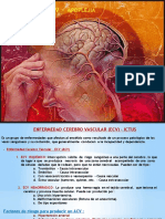 Enf. Cerebro Vascular