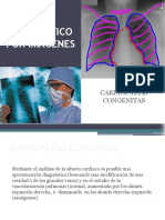 4ta Clase CARDIOPATIA CONGENITA