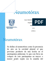 NEUMOTORAX