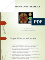 Arteriographie Cerebrale: DR Toumi Nozha CHU Habib Bourguiba Sfax