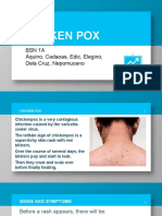 Chicken Pox: BSN 1A Aquino, Cadaoas, Edic, Elegino, Dela Cruz, Nepomuceno