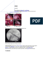 Cholecystectomy: Navigation Search