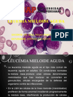 Leucemia Mieloide Aguda