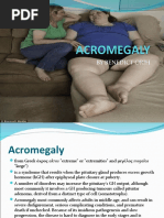 Acromegaly