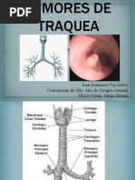 Tumores de Traquea (Clase)