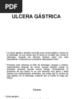 Ulcera Gastrica