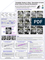 MR Imaging of The Fetal Cerebellar Vermis in Utero: Description of Some Useful Anatomical Criteria For Normal Development