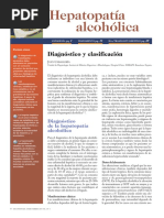 Hepatopatía Alcohólica: Diagnóstico y Clasificación