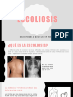 Escoliosis