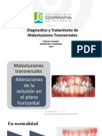 DX y Tto Maloclusiones Transversales