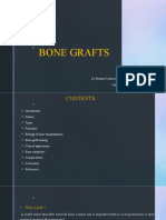 Bone Grafts Bhanu