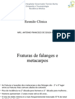 Fratura de Metacarpo e Falange-3