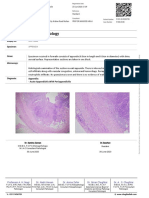 Department of Histopathology: Appendix: - Acute Appendicitis With Periappendicitis