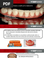 Expocicion de Protesis Inmediata Completa Uap