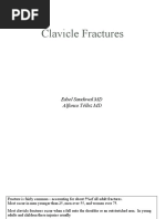 Clavicle Fractures: Edsel Sandoval MD Alfonso Téllez MD