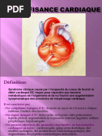 L'insuffisance Cardiaque