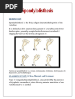 Varieties of Spondylolisthesis: (A) Normal, (B) Congenital, (C) Isthmic, (D) Traumatic, (E) Degenerative, and (F) Pathological