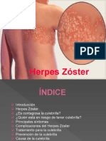 Herpes Zoster