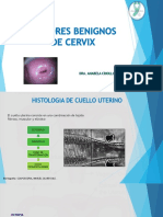 Tumores Benignos Del Cérvix PDF