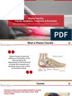 Plantar Fasciitis Causes, Symptoms, Treatment and Prevention