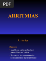 ARRITMIAS