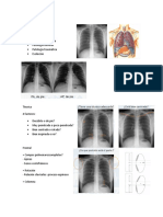 Radiología de Tórax