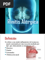 Rinitis Alérgica