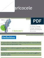 VARICOCELE