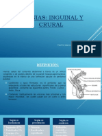 Hernias Inguinales o Crurales (Autoguardado)