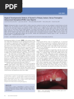 Atypical Developmental Defects of Enamel in Primary Incisors Versus Preeruptive Intracoronal Resorption (PEIR) : Case Reports