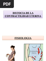 Distocia de La Contractilidad