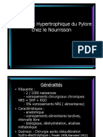 Sténose Pylore