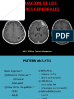 Tumor Cerebral