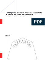 Conceperea Planului Protezei Scheletate in Funtie de Clasa de Edentatie