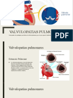 Valvulopatias Pulmonares