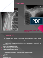 Diapositivas Acerca de Fracturas