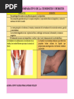 Cuadro Comparativo de Tendinitis y Bursitis