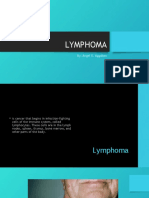 Lymphoma: By: Angel R. Aggabao